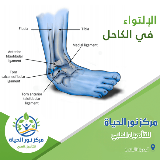 تصميم بوسترات