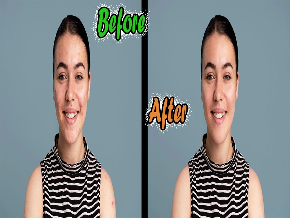 ازالة الحبوب من الوجه مع المحافضة علي تفاصيل الصورة