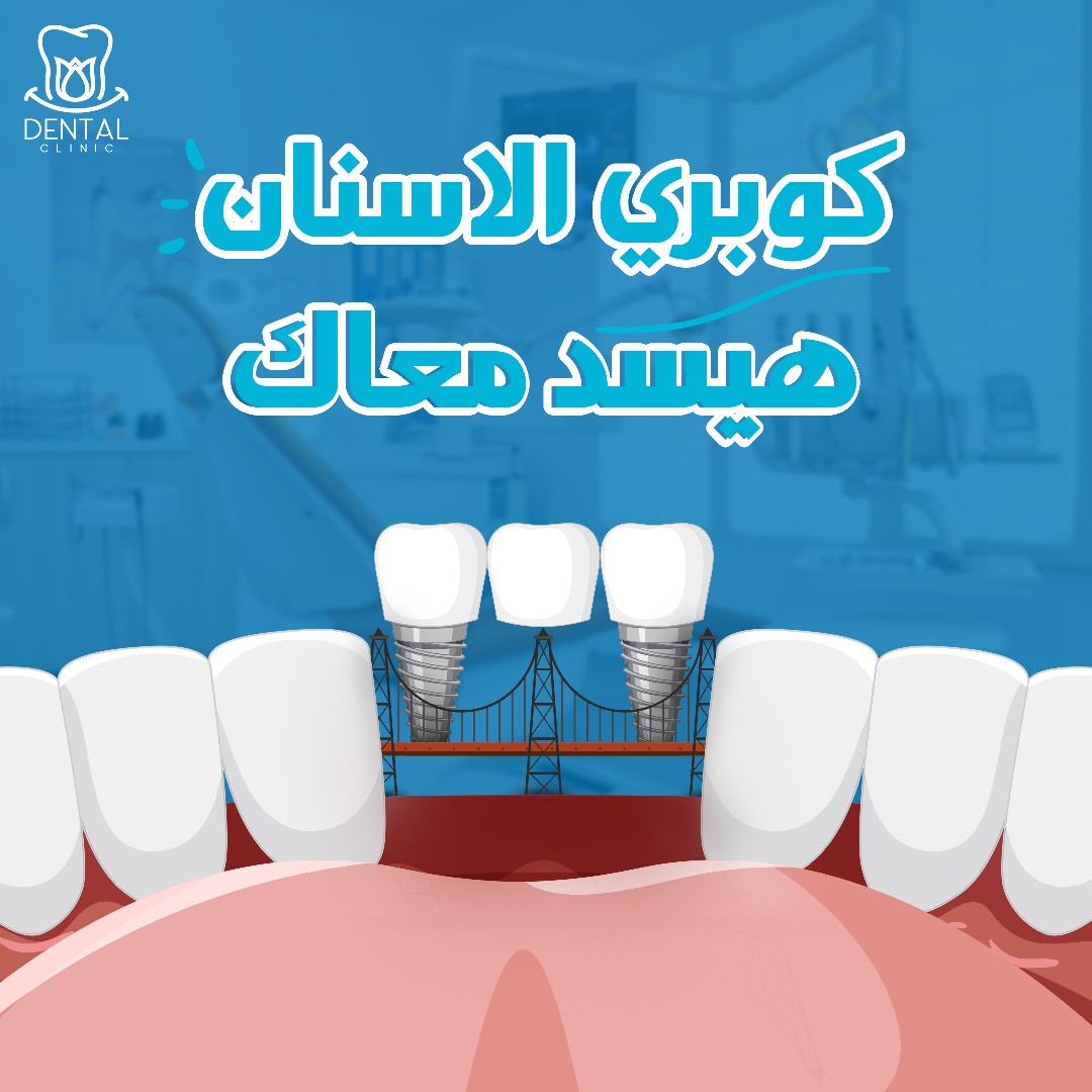Dental design