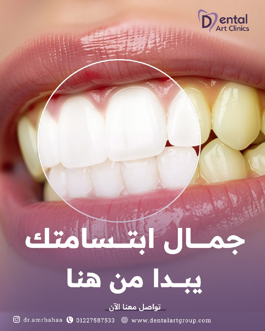 تصميمات جرافيك احترافية للسوشيال ميديا والبراندات

أو